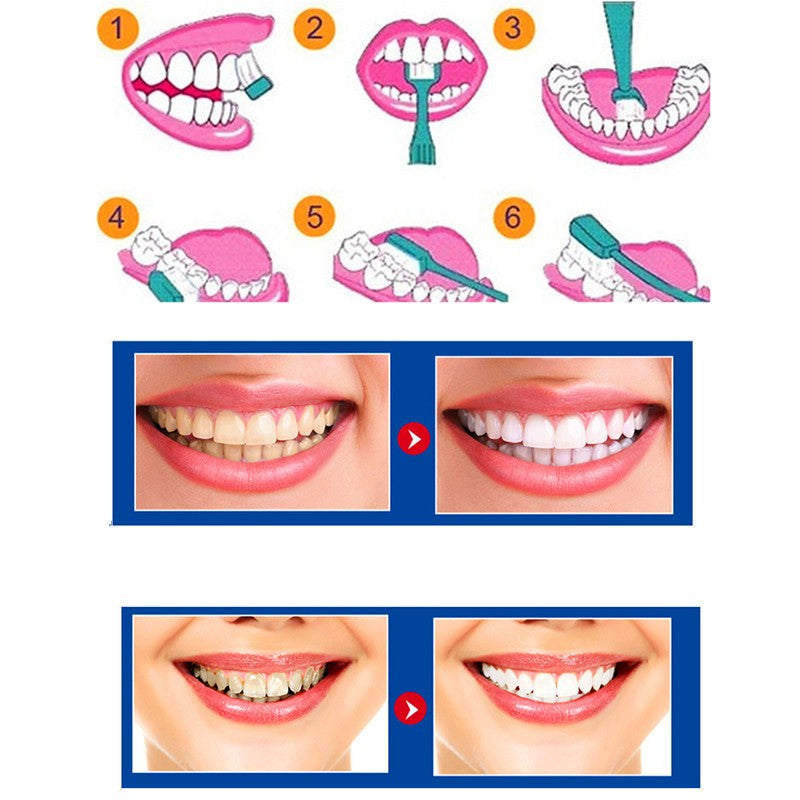 Teeth whitening