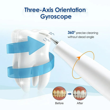 Dental Scaler Visual Precision Tartar and Stain Removal with Camera