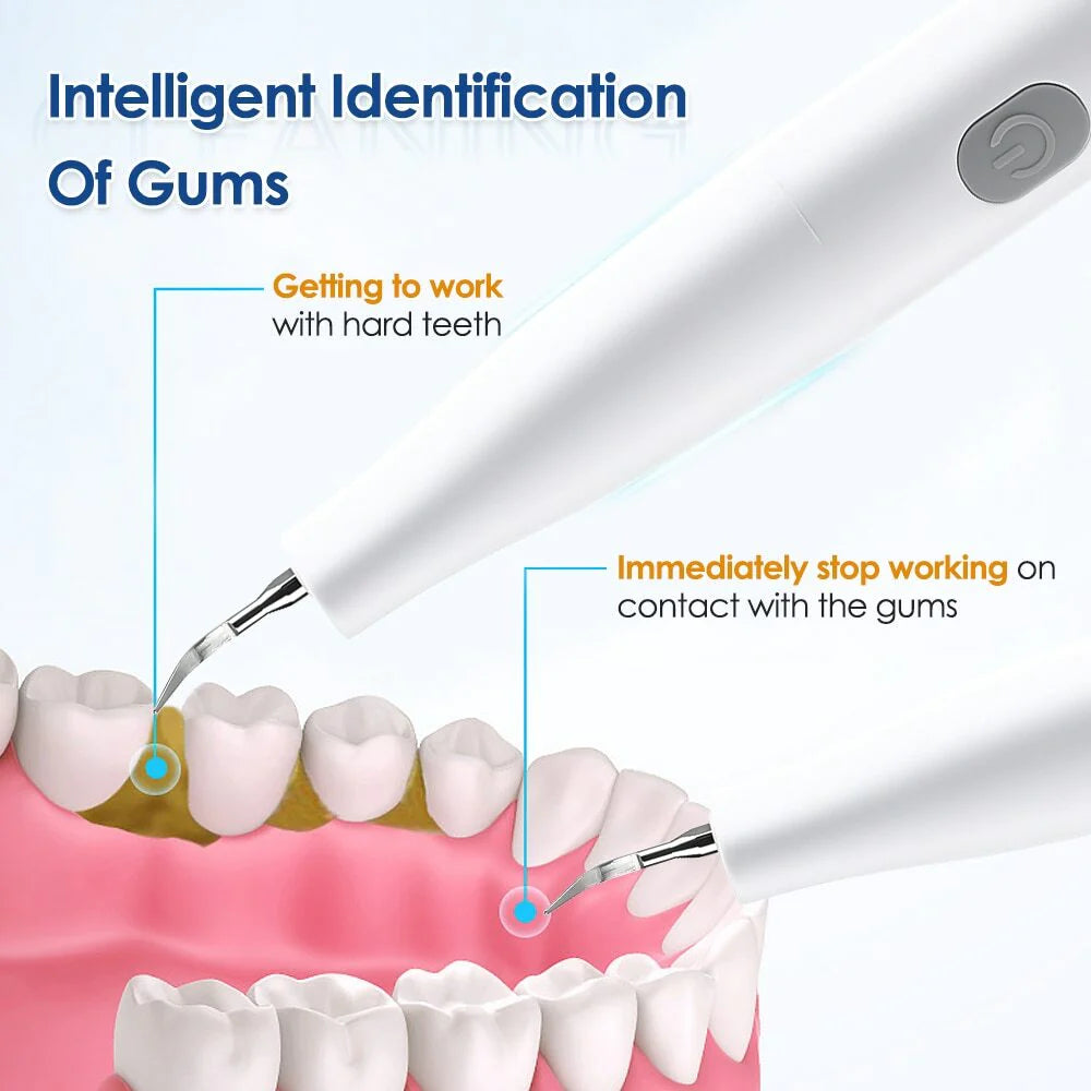 Scaler ทันตกรรม Visual Precision Tartar และการกำจัดคราบด้วยกล้อง